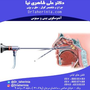 آندوسکوپی بینی و سینوس