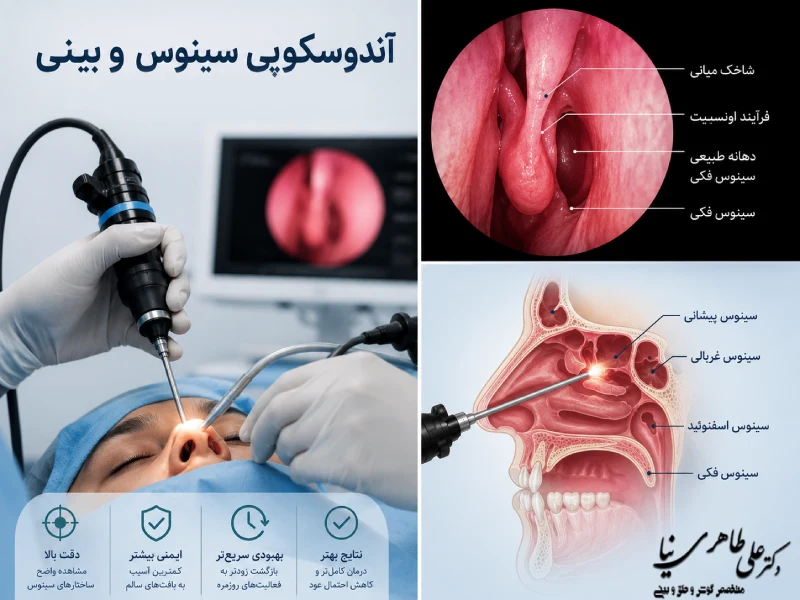 آندوسکوپی سینوس و بینی