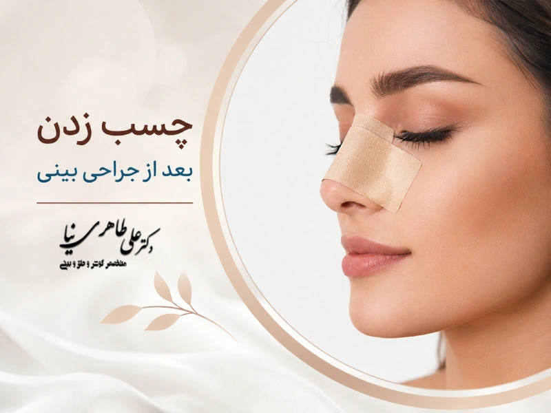 چسب زدن بعد از جراحی بینی