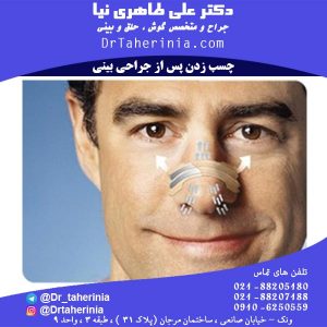 چسب زدن پس از جراحی بینی
