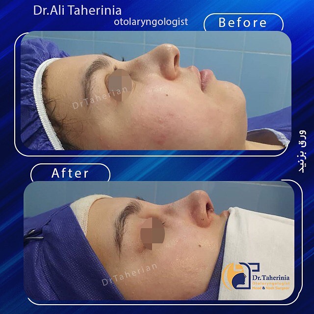 نمونه-کار-عمل-بینی