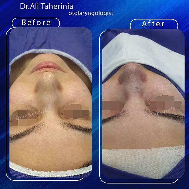 نمونه-کار-عمل-بینی-دکتر-علی-طاهری-نیا