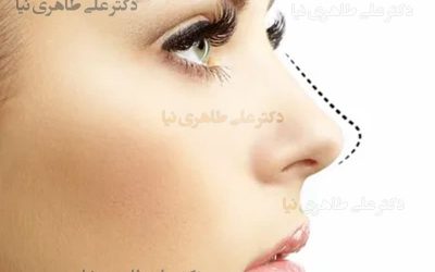 بهترین دکتر برای عمل ترمیمی بینی