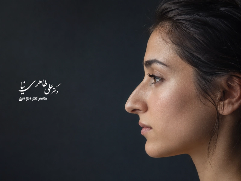 افتادگی بینی