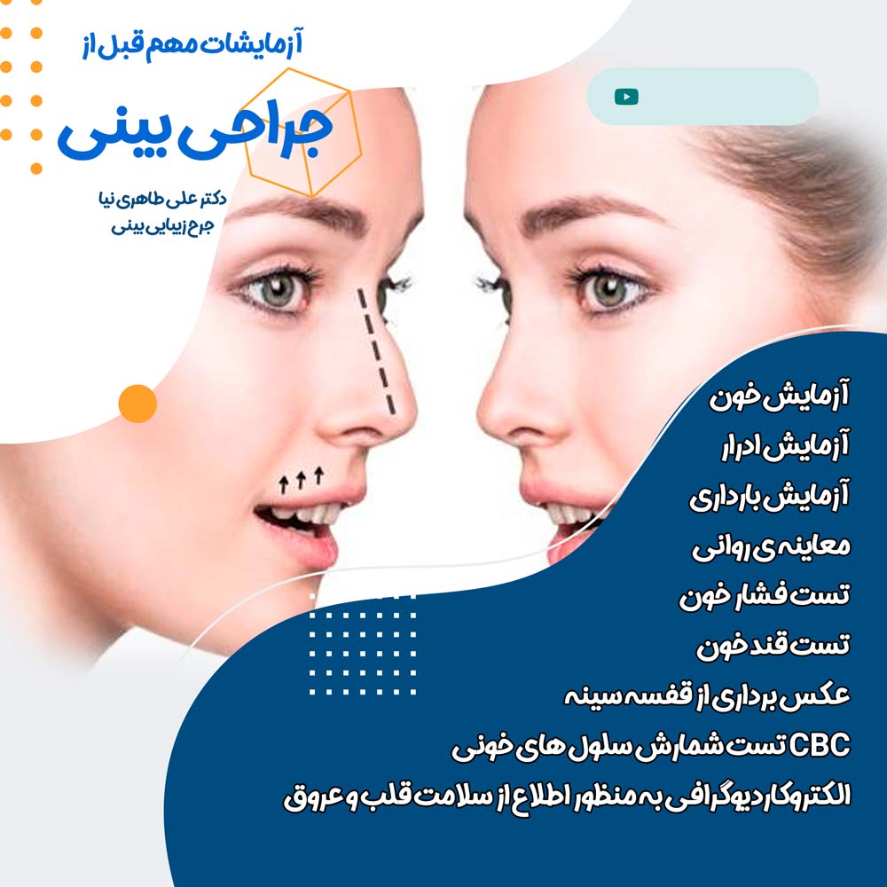 آزمایشات-قبل-از-جراحی-بینی