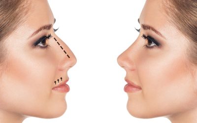 انواع روش های جراحی بینی