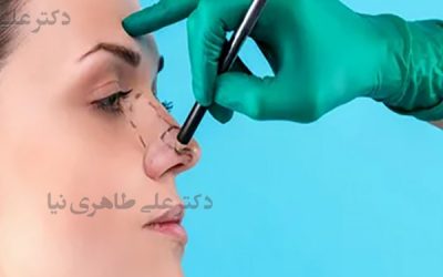 معرفی بهترین جراح بینی گوشتی در تهران + نمونه کارهای واقعی