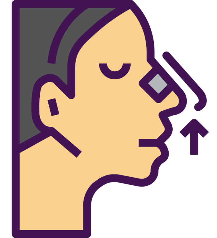 سپتورینوپلاستی