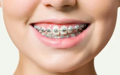 ارتودنسی و جراحی بینی؛ کدام باید اول انجام شود؟