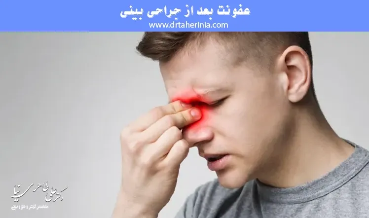 عفونت بعد از جراحی بینی