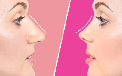 حقایق عمل بینی عروسکی برای یک تصمیم آگاهانه