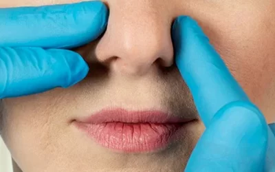 هزینه جراحی بینی در سال 1404 چقدر است؟