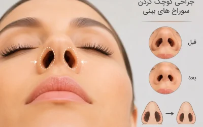 کوچک کردن سوراخ های بینی