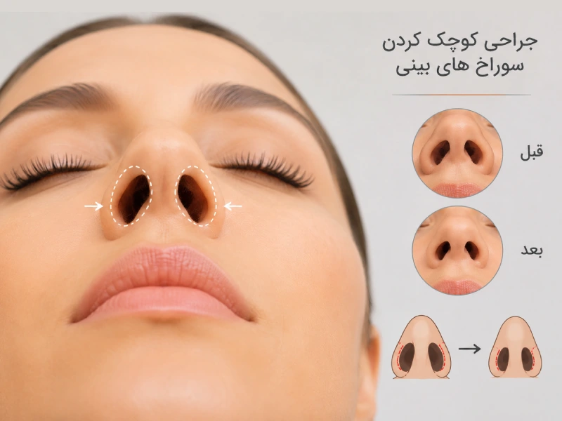 جراحی کوچک کردن سوراخ های بینی